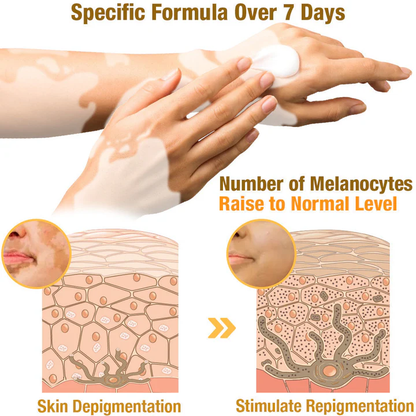 Oveallgo™ BeeVenom Vitiligo Treatment Cream