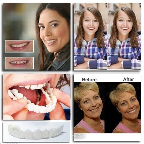 Oveallgo™ Adjustable Snap-On Dentures