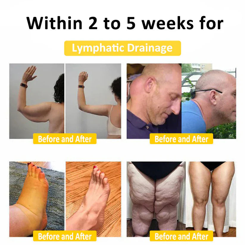 Oveallgo™ Bee Venom Lymphatic Drainage Slimming Soap (for all lymphatic problems and obesity)