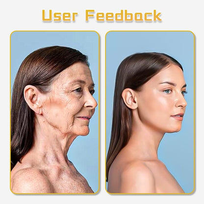 Oveallgo™ UltraRenew Ultrasonic Facelift Device