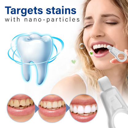 Oveallgo™ NanoShine Tooth Stain Cleaner