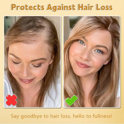 Oveallgo™ Biotin Hair Growth Essence Spray