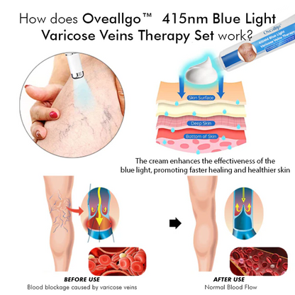 Oveallgo™ 415NM Blue Light Varicose Veins Therapy Set