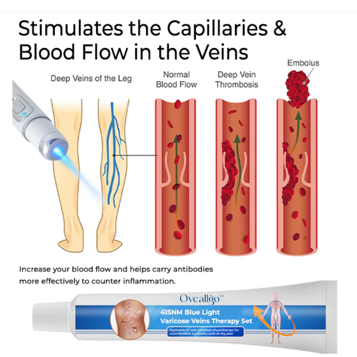 Oveallgo™ 415NM Blue Light Varicose Veins Therapy Set