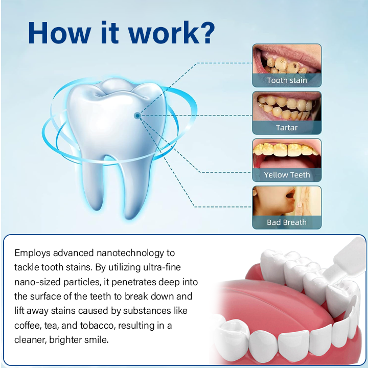 Oveallgo™ NanoShine Tooth Stain Cleaner