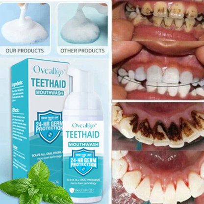 ✨Dentist-Recommended 🦷 Oveallgo™ Intensive Stain Removal Oral Cleansing Mousse