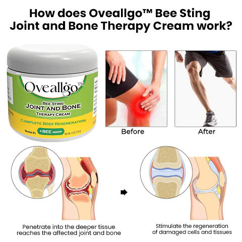 Oveallgo™ Bee Sting Joint and Bone Therapy Cream - Complete Body Regeneration