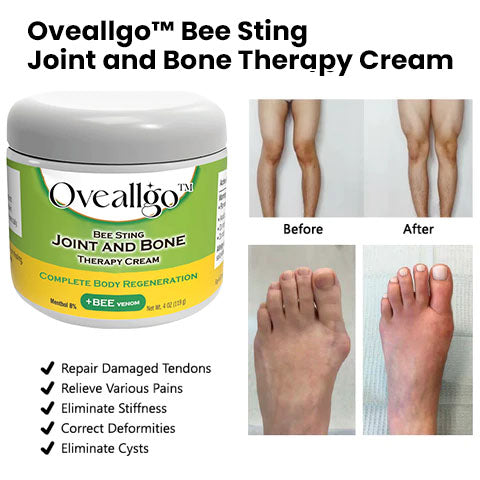 Oveallgo™ Bee Sting Joint and Bone Therapy Cream - Complete Body Regeneration