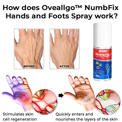 Oveallgo™ NumbFix Hands and Foots Spray